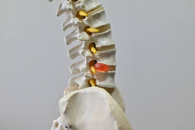 椎間板ヘルニアについて｜椎間板ヘルニアと診断された方、さくがわ接骨院のオステオパシーで施術可能です。